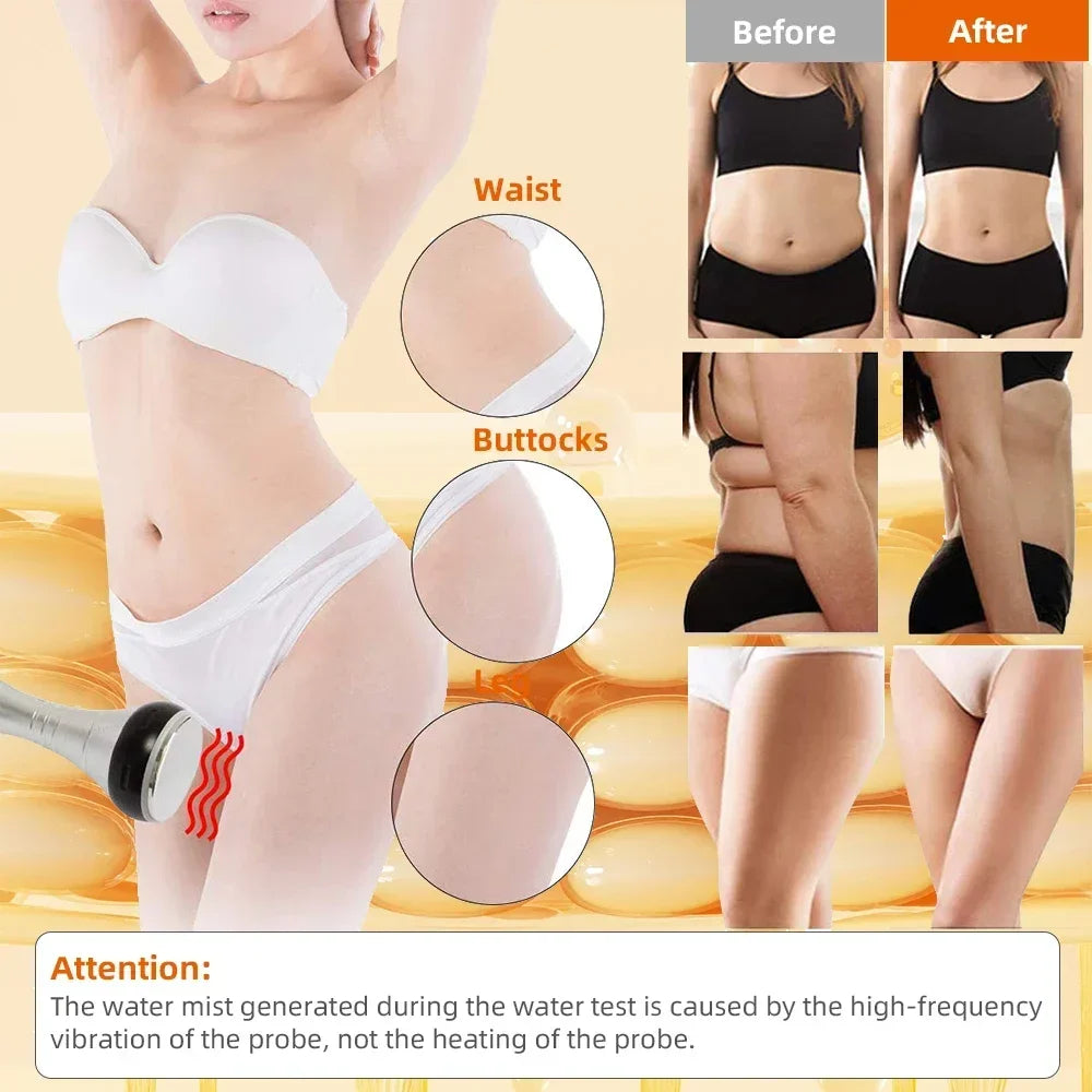 Missheart 40K Cavitation Body Slimming Machine With Vacuum Suction