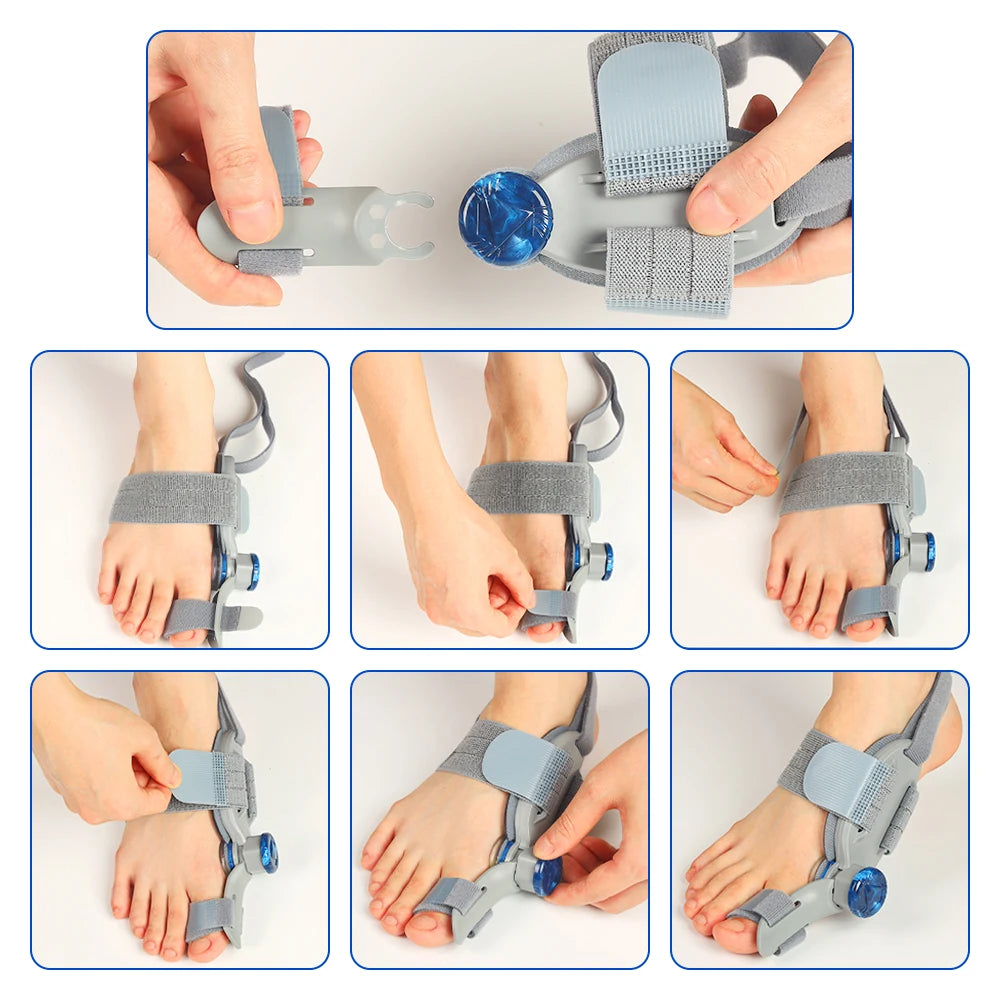 Moajaza Adjustable Hallux Valgus Toe Brace For Bunion Correction